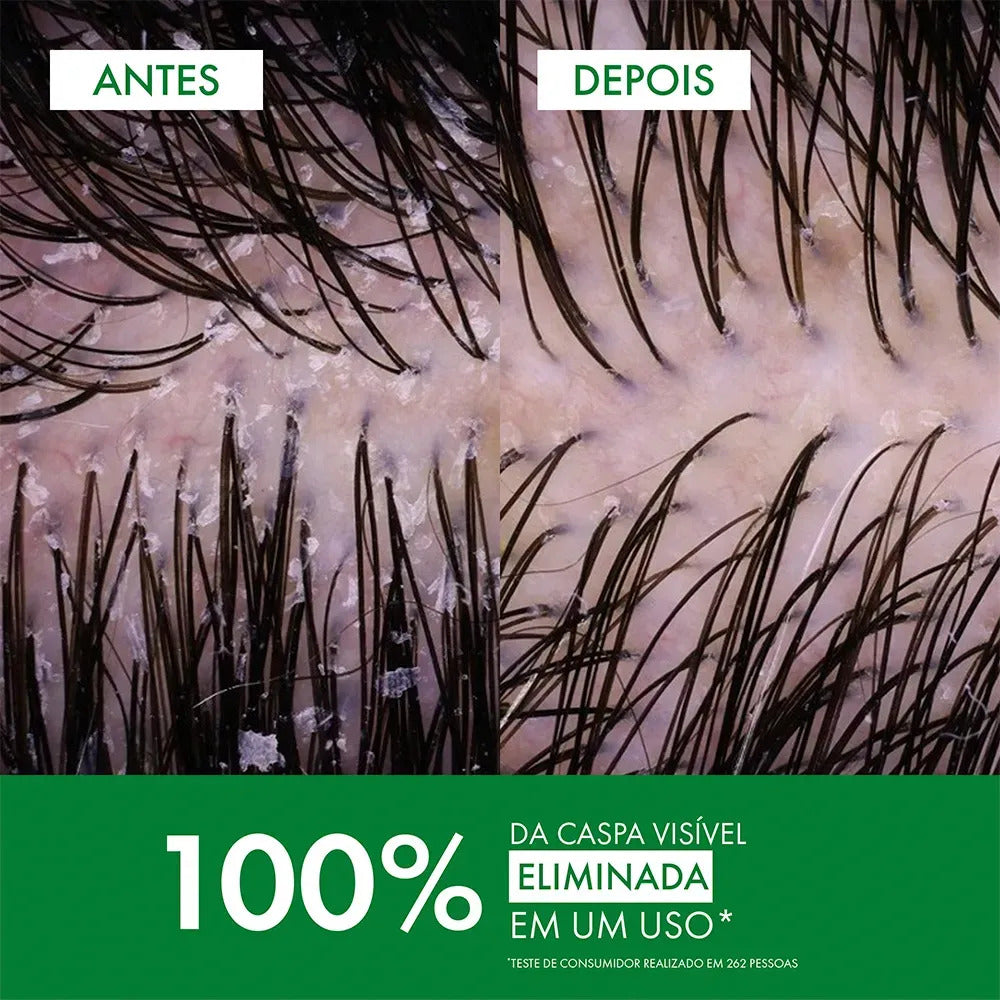 Shampoo Anticaspa para Normais a Oleosos com Selênio DS, DS Dercos Vichy, 300ml