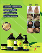 Monohair Pro A Vitamin A Hair Growth Kit | 4 Products
